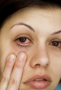 Sick woman's eyes=need for eliminating inflammation